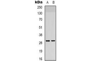 Western blot analysis of ATP5F1 expression in K562 (A), NIH3T3 (B) whole cell lysates. (ATP5F1 抗体)