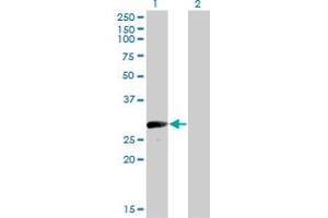 Western Blot analysis of VGLL1 expression in transfected 293T cell line by VGLL1 monoclonal antibody (M01), clone 3C7. (VGLL1 抗体  (AA 1-100))