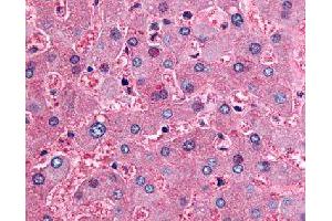 Immunohistochemical (Formalin/PFA-fixed paraffin-embedded sections) staining in human liver with DPP9 polyclonal antibody . (DPP9 抗体)