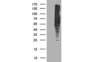 HEK293T cells were transfected with the pCMV6-ENTRY control (Left lane) or pCMV6-ENTRY DLD (Right lane) cDNA for 48 hrs and lysed. (DLD 抗体)