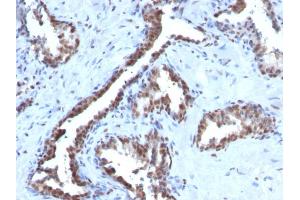 Immunohistochemistry (IHC) image for anti-Cyclin B1 (CCNB1) antibody (ABIN6940990)