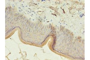 Immunohistochemistry (IHC) image for anti-Keratin 10 (KRT10) (AA 1-584) antibody (ABIN7157372)