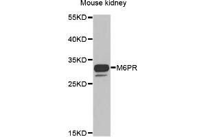 Western blot analysis of extracts of mouse kidney, using M6PR antibody. (M6PR 抗体)
