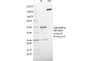 SDS-PAGE (SDS) image for anti-5'-Nucleotidase, Ecto (CD73) (NT5E) antibody (ABIN6940227)