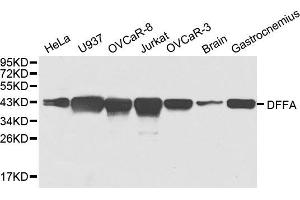 Western blot analysis of extracts of various cell lines, using DFFA antibody. (DFFA 抗体)