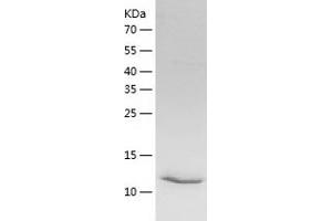 Western Blotting (WB) image for Intelectin 2 (ITLN2) (AA 39-175) protein (His tag) (ABIN7123477) (ITLN2 Protein (AA 39-175) (His tag))
