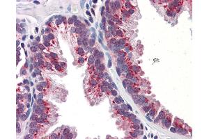 Immunohistochemistry (IHC) image for anti-Kruppel-Like Factor 4 (Gut) (KLF4) (C-Term) antibody (ABIN2780577) (KLF4 抗体  (C-Term))