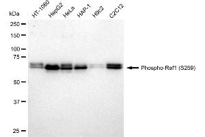 Western blotting analysis using Phospho-Raf1 (S259) antibody (ABIN7800802).