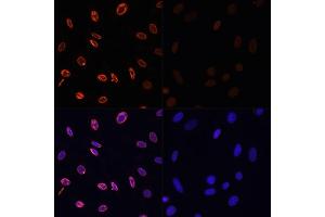Immunofluorescence analysis of NIH/3T3 cells using Acetyl-Histone H3-K36 antibody (ABIN7267671) at dilution of 1:100. (Histone 3 抗体  (H3K36))