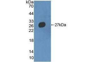 Detection of Recombinant MMRN2, Mouse using Polyclonal Antibody to Multimerin 2 (MMRN2)