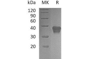 Western Blotting (WB) image for Cytokine Receptor-Like Factor 2 (CRLF2) protein (His tag) (ABIN7320658)