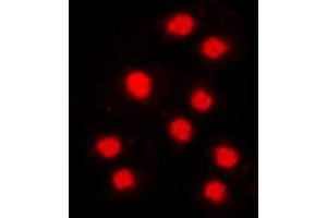 Immunofluorescent analysis of Cyclin A1 staining in MCF7 cells. (Cyclin A1 抗体  (C-Term))