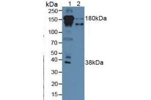 Rabbit Detection antibody from the kit in WB with Positive Control: Sample Lane1: Human Serum; Lane2: Human Liver Tissue. (Complement Factor H ELISA 试剂盒)