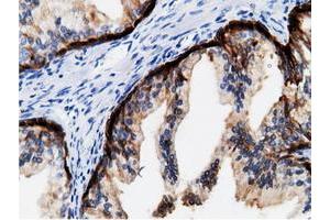 Immunohistochemical staining of paraffin-embedded Human colon tissue using anti-CRYM mouse monoclonal antibody. (CRYM 抗体)