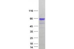Western Blotting (WB) image for Zinc Finger Protein 207 (ZNF207) (Transcript Variant 3) protein (Myc-DYKDDDDK Tag) (ABIN2735957)