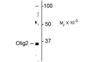 Image no. 1 for anti-Oligodendrocyte Lineage Transcription Factor 2 (OLIG2) antibody (ABIN372693) (OLIG2 抗体)
