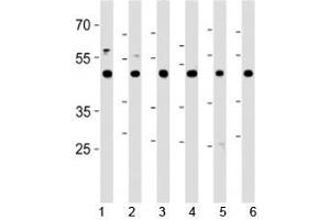 Western Blotting (WB) image for anti-C-terminal Binding Protein 1 (CTBP1) (AA 413-440) antibody (ABIN3030236)