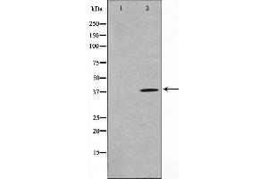Western blot analysis on HuvEc cell lysate using TNFSF11 Antibody. (RANKL 抗体  (Internal Region))