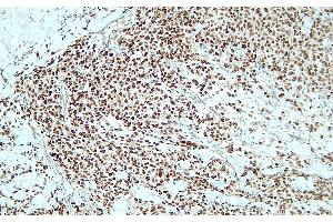 Immunohistochemistry (IHC) image for anti-SRY (Sex Determining Region Y)-Box 10 (SOX10) (C-Term) antibody (ABIN7598799) (SOX10 抗体  (C-Term))