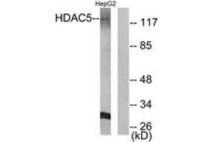 Western blot analysis of extracts from HepG2 cells, using HDAC5 (Ab-259) Antibody.