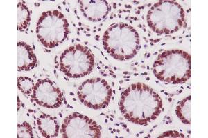 Immunohistochemical analysis of paraffin-embedded human colon, using Phospho-DNA PKcs (S2056) Antibody. (Recombinant PRKDC 抗体  (pSer2056))