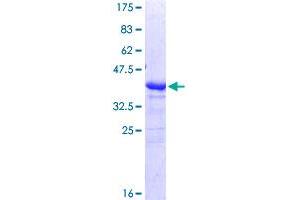 Image no. 1 for Tumor-Associated Calcium Signal Transducer 2 (TACSTD2) (AA 31-140) protein (GST tag) (ABIN1322053)