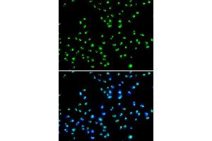 Immunofluorescence analysis of MCF-7 cells using N antibody (ABIN6132968, ABIN6144376, ABIN6144377 and ABIN6223123). (NAT10 抗体  (AA 1-250))