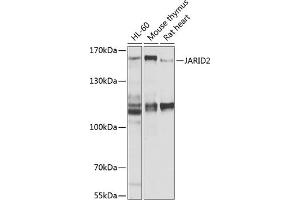 Western blot analysis of extracts of various cell lines, using J antibody (ABIN6129402, ABIN6142653, ABIN6142654 and ABIN6225131) at 1:1000 dilution. (JARID2 抗体  (AA 1027-1246))