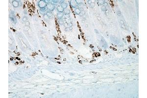 Immunohistochemistry (IHC) image for anti-Nitrotyrosine antibody (ABIN361658)