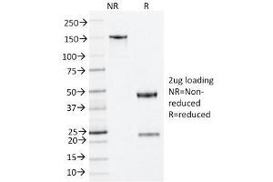 SDS-PAGE Analysis Purified Nucleophosmin Mouse Monoclonal Antibody (NA24). (NPM1 抗体  (N-Term))