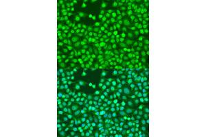 Immunofluorescence analysis of U2OS cells using Smad2 antibody (ABIN4905224) at dilution of 1:100. (SMAD2 抗体)