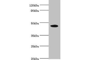 Western blot All lanes: STK32A antibody at 5 μg/mL + HepG2 whole cell lysate Secondary Goat polyclonal to rabbit IgG at 1/10000 dilution Predicted band size: 47, 20, 42 kDa Observed band size: 47 kDa (STK32A 抗体  (AA 1-166))
