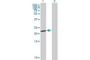 Western Blot analysis of CGB5 expression in transfected 293T cell line by CGB5 MaxPab polyclonal antibody. (CGB5 抗体  (AA 1-165))