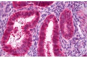 Anti-PCK1 antibody IHC staining of human uterus, endometrium.