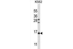 Western Blotting (WB) image for anti-Follicle Stimulating Hormone, beta Polypeptide (FSHB) antibody (ABIN2997110) (FSHB 抗体)
