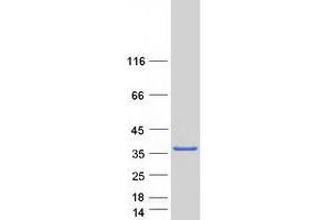 Western Blotting (WB) image for Sulfotransferase Family, Cytosolic, 1C, Member 4 (SULT1C4) protein (Myc-DYKDDDDK Tag) (ABIN2732960)