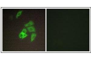 Immunofluorescence analysis of A549 cells, using ST14 Antibody. (ST14 抗体  (N-Term))