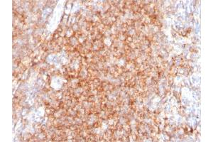 Immunohistochemistry (IHC) image for anti-CD40 (CD40) (AA 29-107) antibody (ABIN6941187)