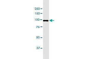 C15orf55 monoclonal antibody (M03), clone 8B1. (NUT (AA 1033-1132) 抗体)