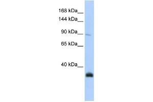 Western Blotting (WB) image for anti-MORC Family CW-Type Zinc Finger 3 (MORC3) (N-Term) antibody (ABIN2782386)