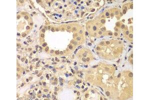 Immunohistochemistry of paraffin-embedded Human kidney using ARNT2 Polyclonal Antibody at dilution of 1:100 (40x lens). (ARNT2 抗体)