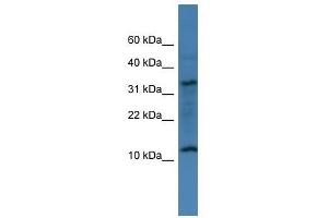Western Blot showing C14orf177 antibody used at a concentration of 1-2 ug/ml to detect its target protein. (C14ORF177 抗体  (N-Term))