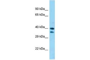WB Suggested Anti-Sav1 Antibody Titration: 1. (SAV1 抗体  (C-Term))