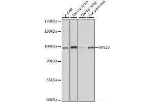 Western blot analysis of extracts of various cell lines using VPS16 Polyclonal Antibody at dilution of 1:1000. (VPS16 抗体)