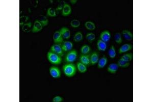 Immunofluorescence (IF) image for anti-Cytochrome P450, Family 17, Subfamily A, Polypeptide 1 (CYP17A1) (AA 1-508) antibody (ABIN7170749)