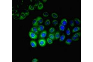 Immunofluorescent analysis of A549 cells using ABIN7170749 at dilution of 1:100 and Alexa Fluor 488-congugated AffiniPure Goat Anti-Rabbit IgG(H+L) (CYP17A1 抗体  (AA 1-508))