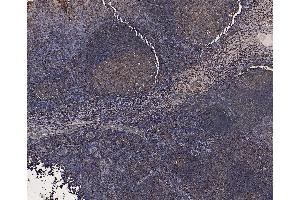 Immunohistochemistry (IHC) image for anti-Cystatin B (Stefin B) (CSTB) (C-Term) antibody (ABIN185101)
