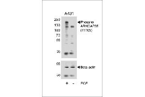 Western blot analysis of lysates from A431 cell line, untreated or treated with EGF, 100 ng/mL, using Phospho-HUN-ARHG (ABIN6241039 and ABIN6578944) (upper) or Beta-actin (lower). (GRLF1 抗体  (pTyr1105))