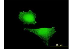 Immunofluorescence (IF) image for anti-Hypoxia Inducible Factor 1, alpha Subunit (Basic Helix-Loop-Helix Transcription Factor) (HIF1A) (AA 1-735) antibody (ABIN516443)