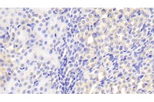 Detection of CLTA in Mouse Kidney Tissue using Polyclonal Antibody to Clathrin, Light Polypeptide A (CLTA) (CLTA 抗体  (AA 5-234))